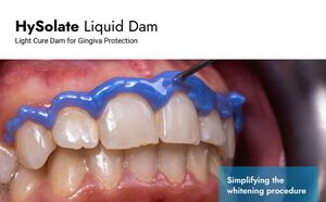 hysolate liquid dam voor gingiva protection
