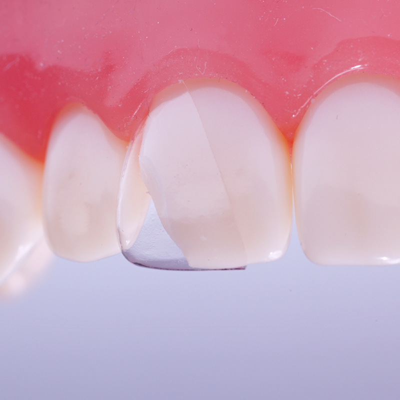 Coform 22m refill - mesiaal