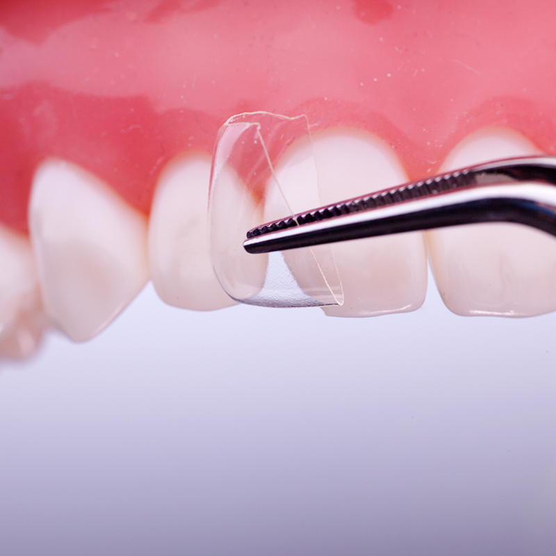 Coform 41-42d refill - distaal