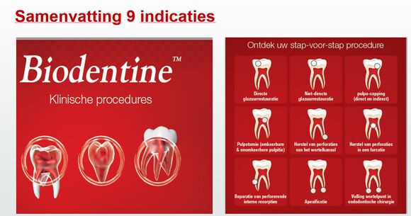 Biodentine xp500 cartridges