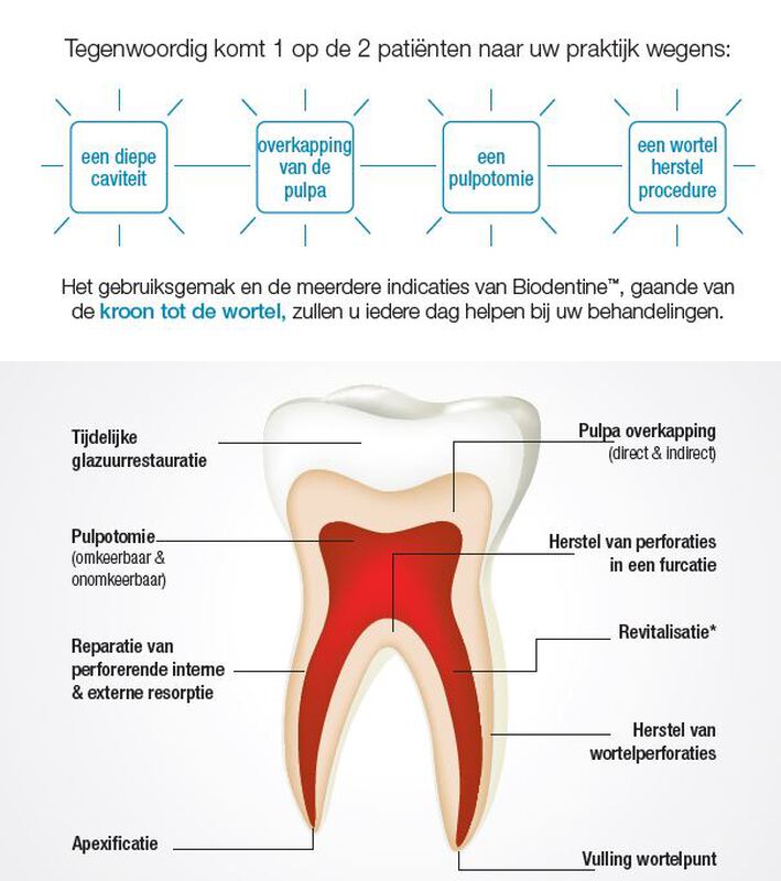 Biodentine xp500 cartridges