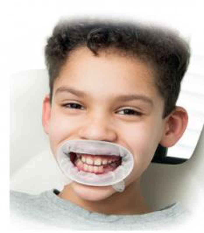 Optragate wit junior refill