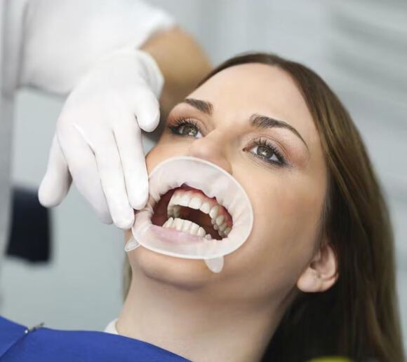 Optragate 2 wit small refill