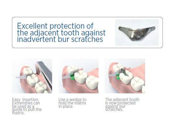 Polydentiapro interproximal tooth protect.matrixen
