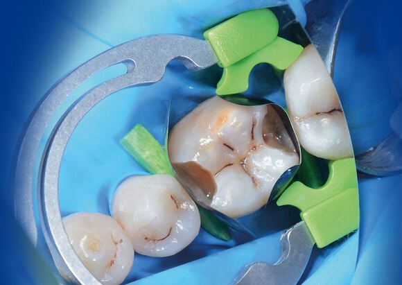 Polydentia mytines go refill 6 paar