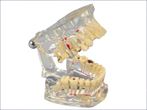 Studiemodel transparant deluxe