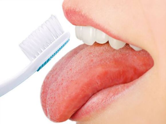 Miradent carebrush supersoft tandenborstel