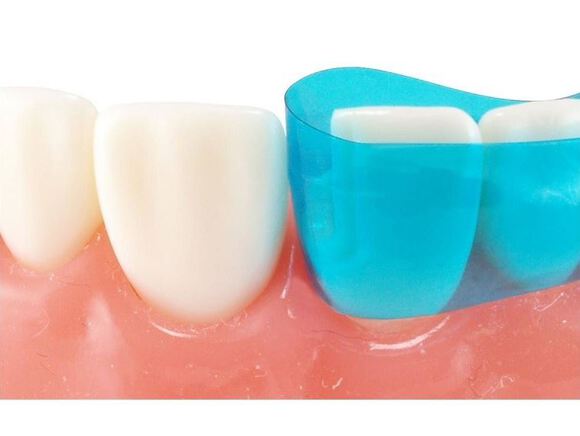 Blue view varistrip anterior matrices