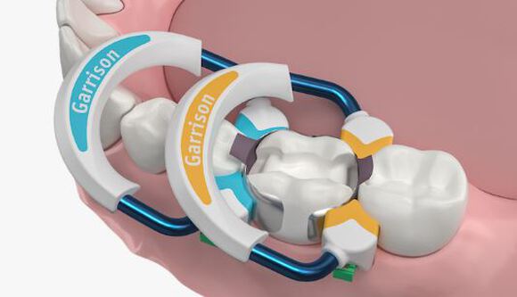 Strata-g sectional matrix standaard set