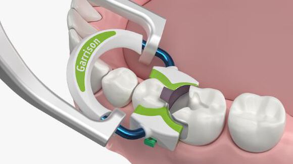 Strata-g sectional matrix standaard set