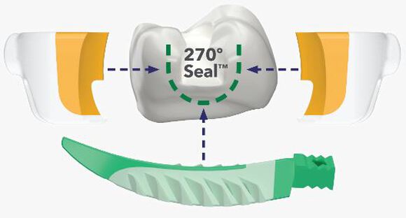Strata-g sectional matrix standaard set