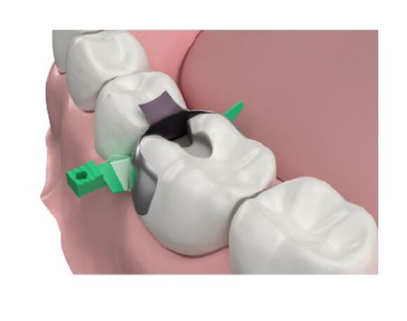 Strata-g wiggen large groen