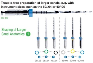 mtwo shape. larger canal anatomies 50/.04 w16 21mm