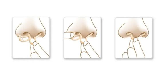Sleepright neusspreider 2-pack