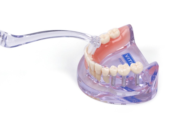 Vitis implant angular tandenborstel