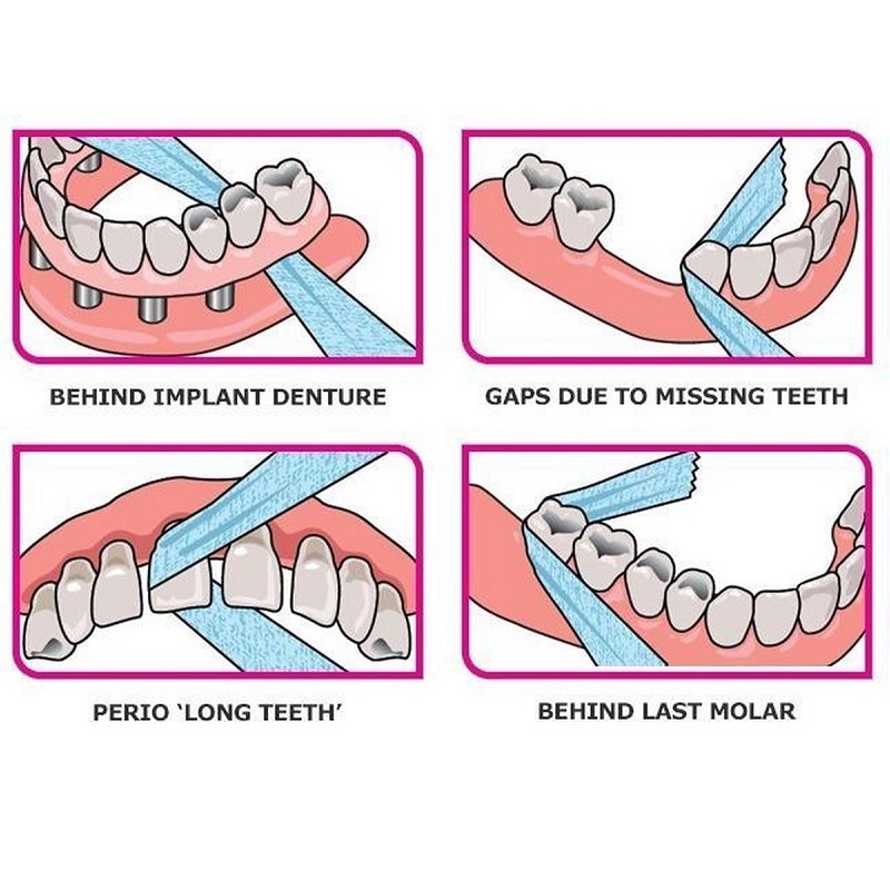 Idontix floss xribbon lint