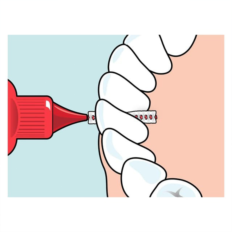 Tepe interdentale ragers original rood 0,5mm(2)