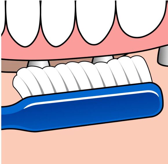 Tepe implant/orthodontie borstel