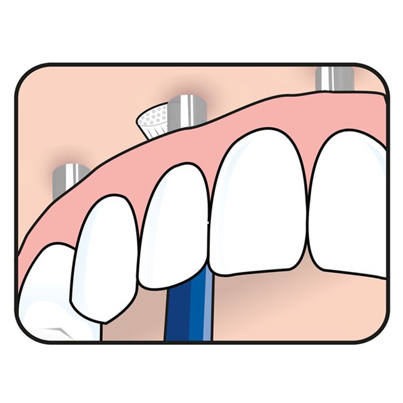 Tepe universal care tandenborstel