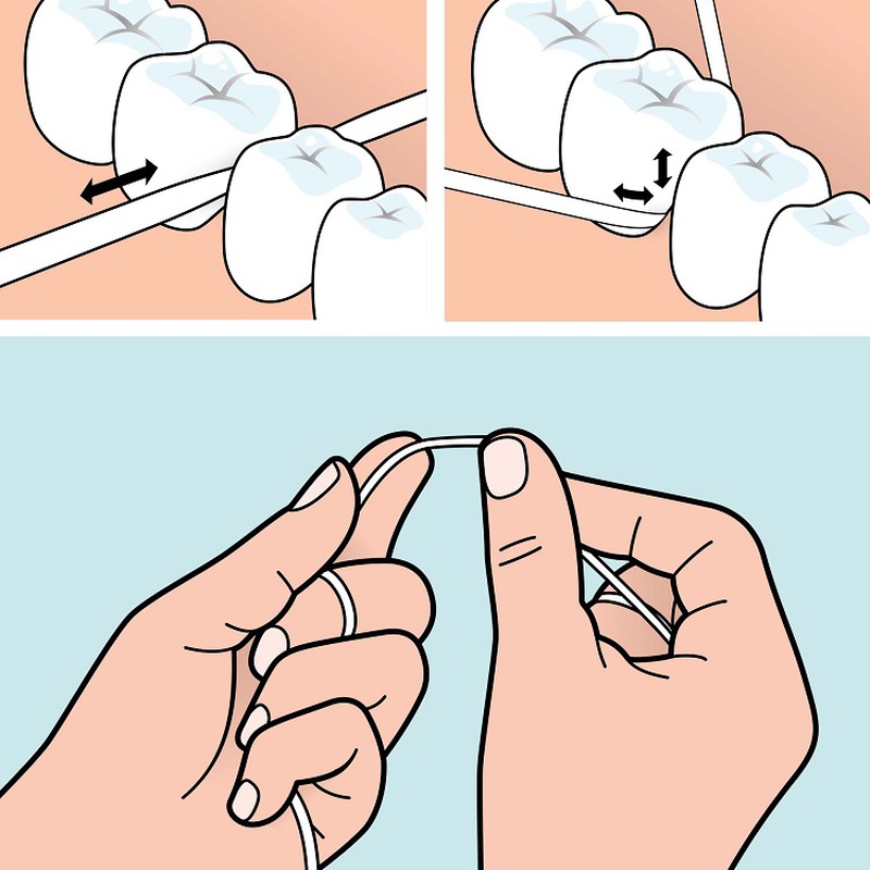 Tepe dental floss