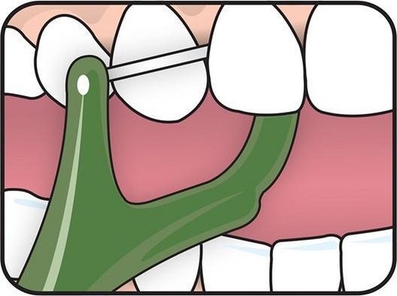 Tepe mini flosser