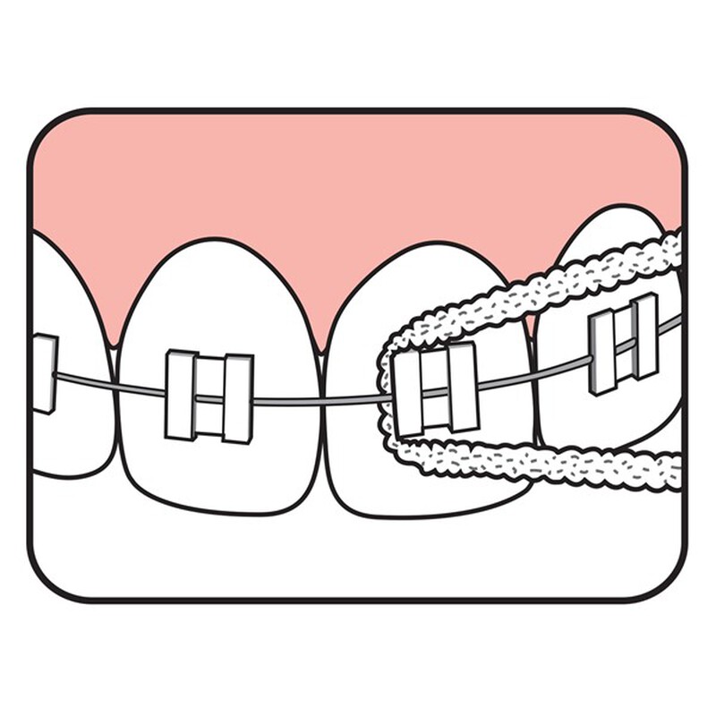 Tepe bridge & implant floss