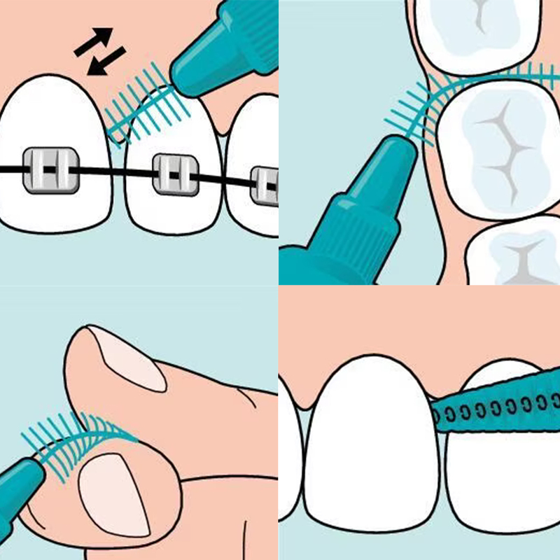 Tepe easyfit interdentale ragers s/m