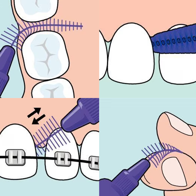 Tepe easyfit interdentale ragers m/l
