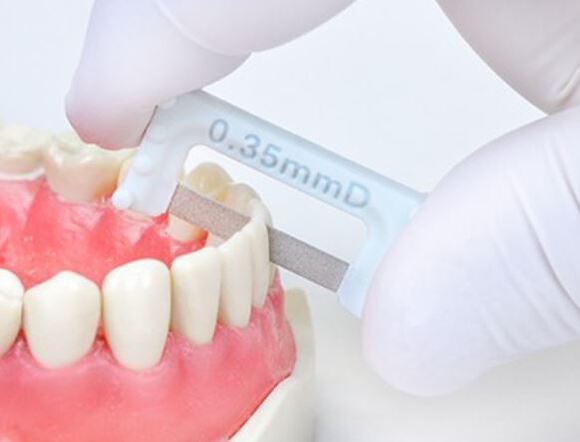 Contacez ipr plus d.s. widener coarse 0.35 mint