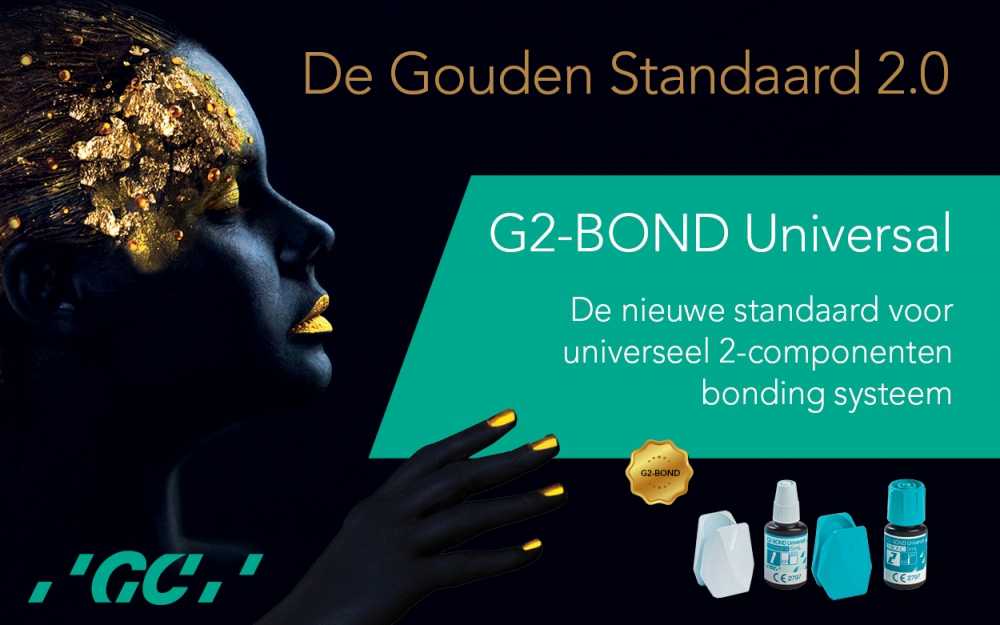 GC G2 Bond